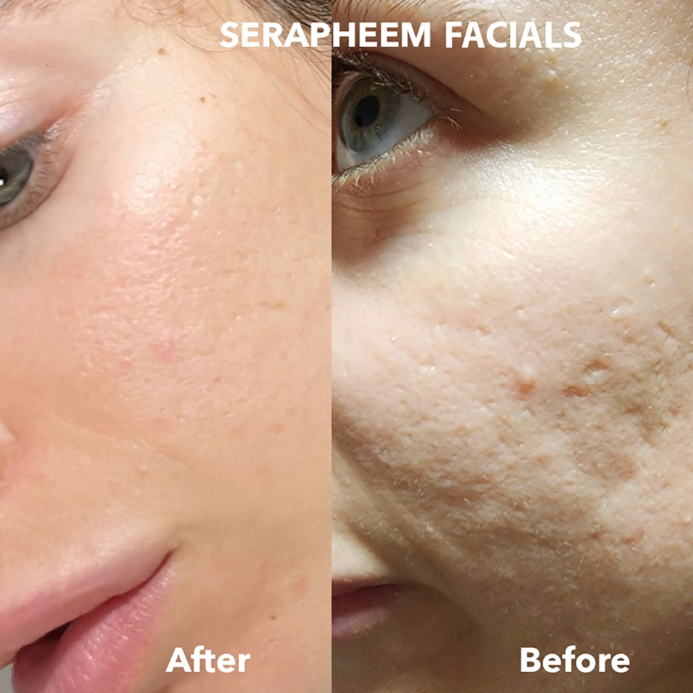 natural skincare