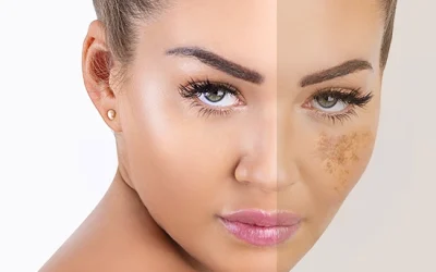 Skin Brightening with MONAD: A Luxurious Cream for Even-Toned Radiance