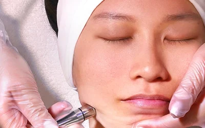 Microdermabrasion : Rejuvenate Your Skin with a Smooth Finish