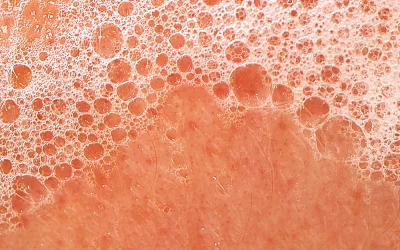 Face Wash : Revitalize Your Skin with the Perfect Cleanser